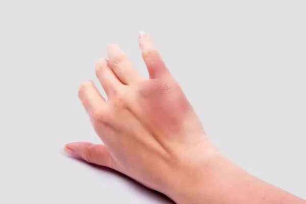 گیاهان دارویی