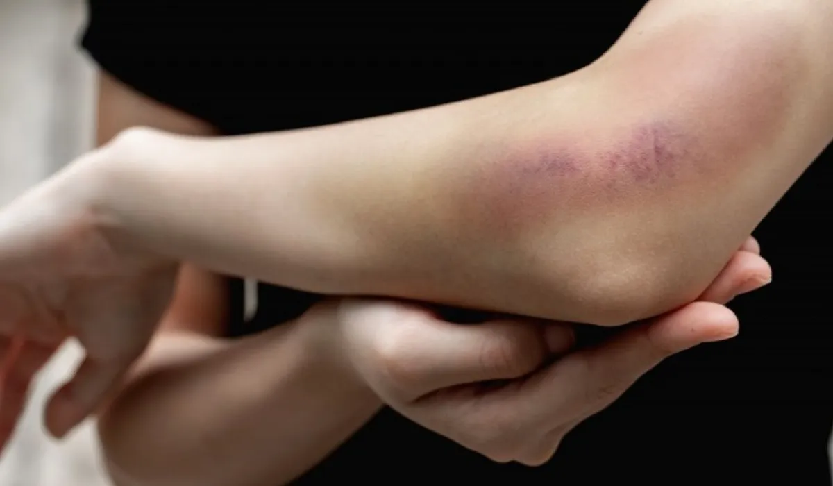 گیاهان دارویی