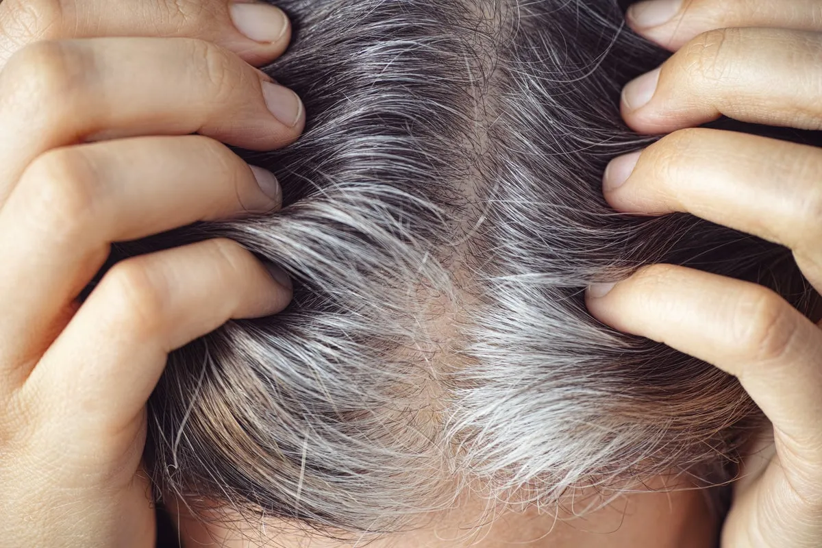 Whitening hair