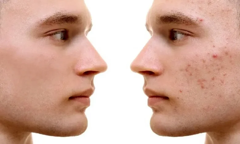 جوش