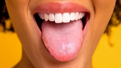 تغییر رنگ زبان نشانه ابتلا به این بیماری است