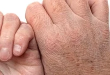 دلیل سیاه شدن طلا