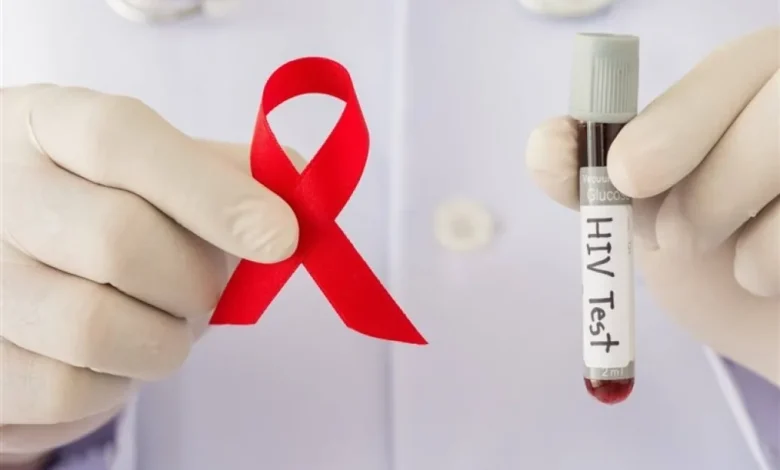 HIV