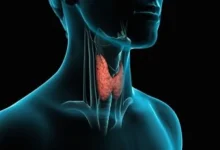 افراد مبتلا به صرع