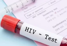 روش جدید پیشگیری از HIV؛ کاهش خطر ابتلا تا ۹۶ درصد