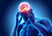 ضربه مغزی