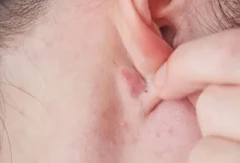 پشت گوش‌