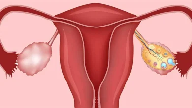 معرفی 5 دمنوش برای تنبلی تخمدان3