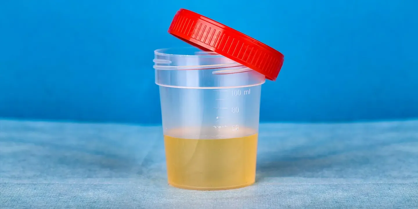 پریناز ایزدیار و شروین حاجیپور