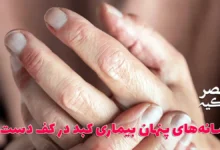 کف دست