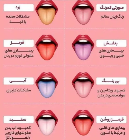 رنگ‌های یک زبان ناسالم