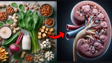 مواد غذایی که سنگ کلیه تولید می کنند