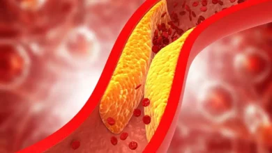 7 تکنیک طلایی برای کاهش کلسترول