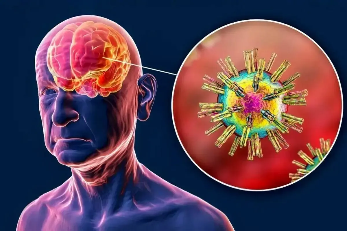 آیا ضربه به سر، ویروس‌ های خفته مغز را بیدار می‌کند؟