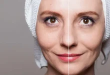 پروتئین گیاهی