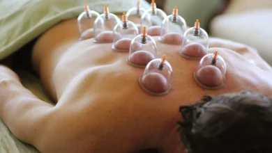 برطرف کردن درد سیاتیک به وسیله بادکش