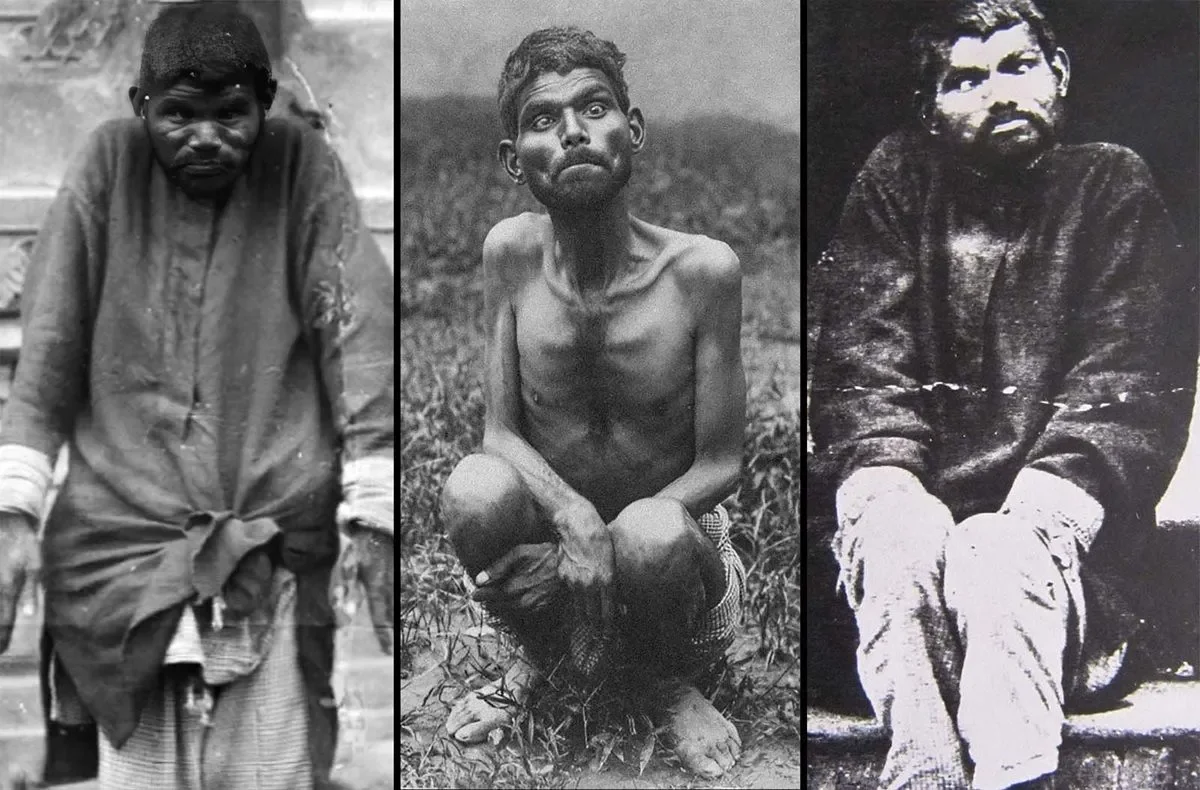 دینا سانیچار؛ پسری وحشی که واقعا با گرگ‌ها بزرگ شده بود