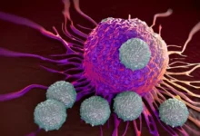 شایعترین سرطان ها