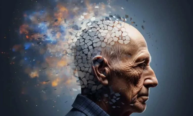 آلزایمر