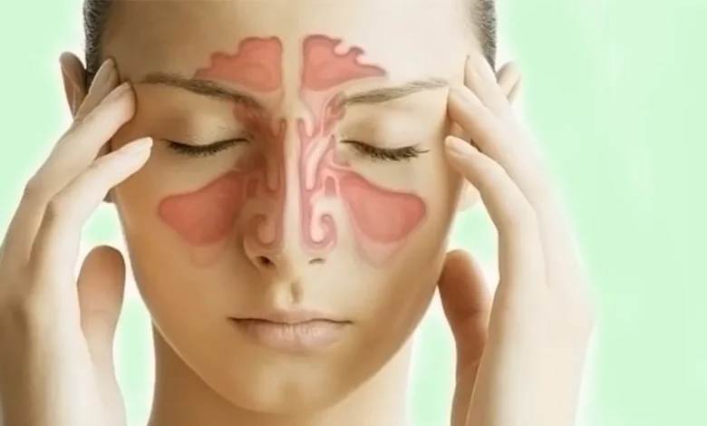 آیا آلرژی می‌تواند موجب التهاب سینوس‌ ها شود؟