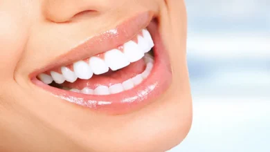 آیا بلیچینگ دندان در دوران بارداری خطرناک است؟