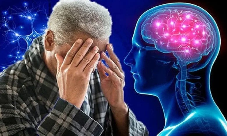 آلزایمر