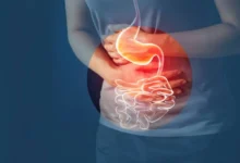 این مشکلات گوارشی باعث افزایش وزن می شوند