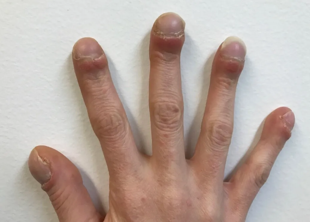 با بررسی ناخن می‌توان فهمید فرد چقدر عمر می‌کند