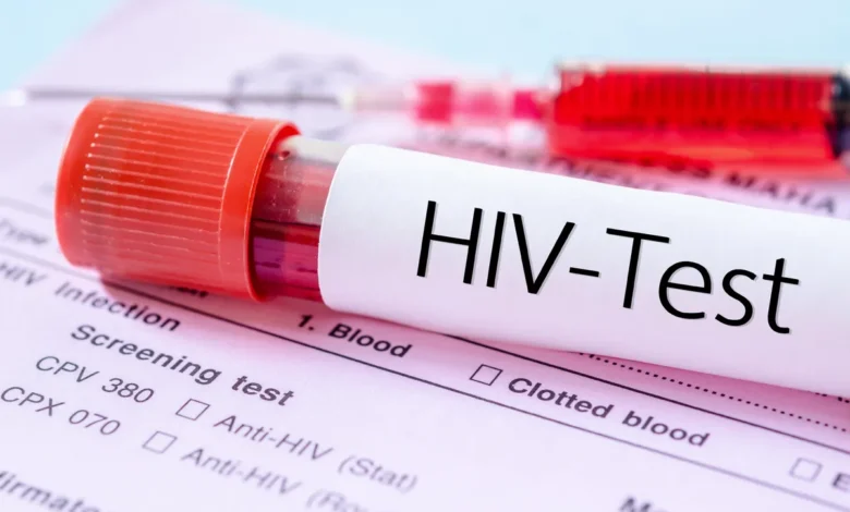 ویروس HIV