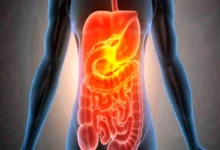 سلامت روده خود را با ماشین حساب محاسبه کنید1