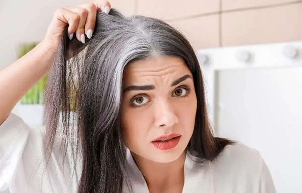 چرا موها در سن پایین سفید می‌شوند؟1