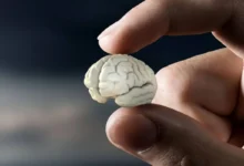 کوچک شدن مغز