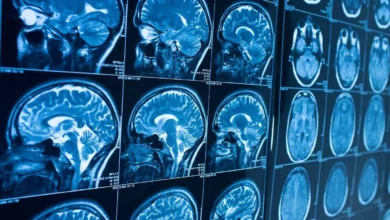 اعضای بدن شما چند ساله‌اند؟