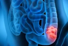 سبزیجات چلیپایی