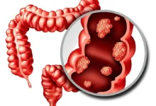 سبزیجات چلیپایی