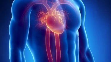 خوابیدن و سکته