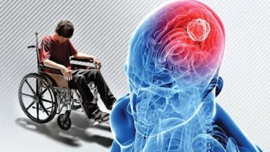 این تغییر در بینایی میتواند نشانه ام اس باشد2