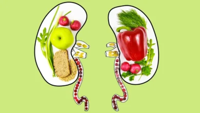 رفلاکس معده
