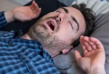 مردن بر اثر پرخوری