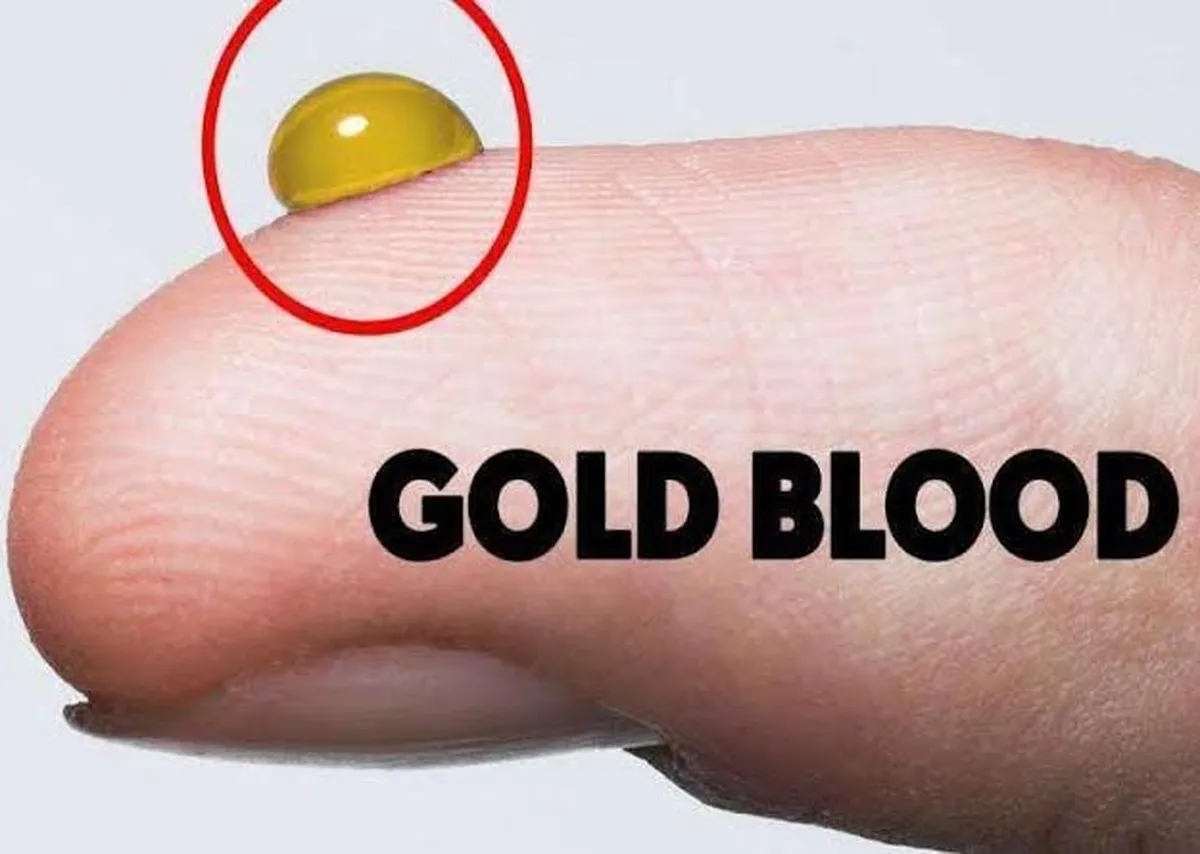 گروه خونی طلایی