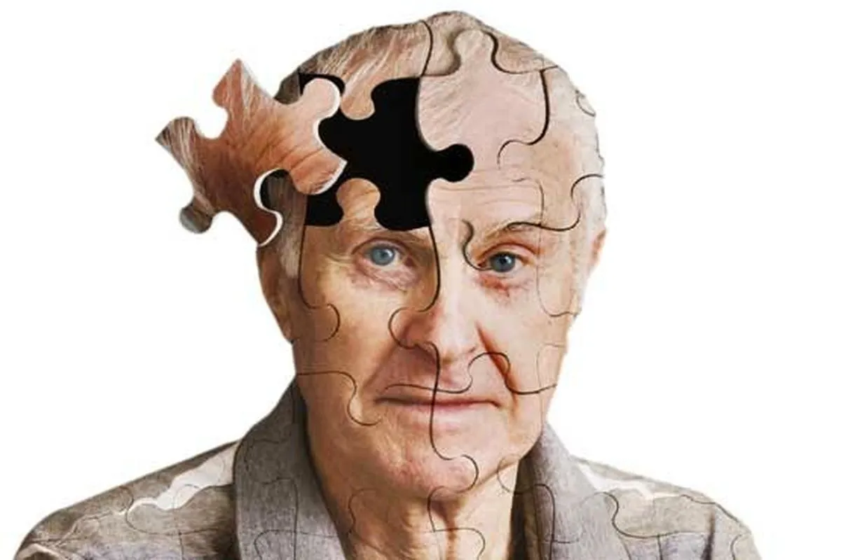 Alzheimers1