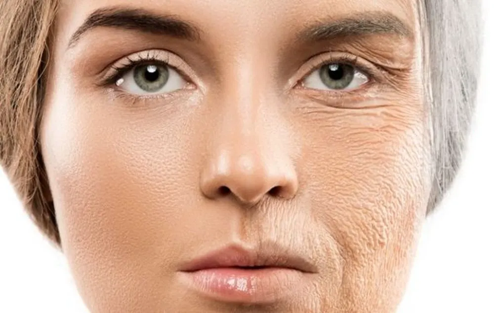 Skin