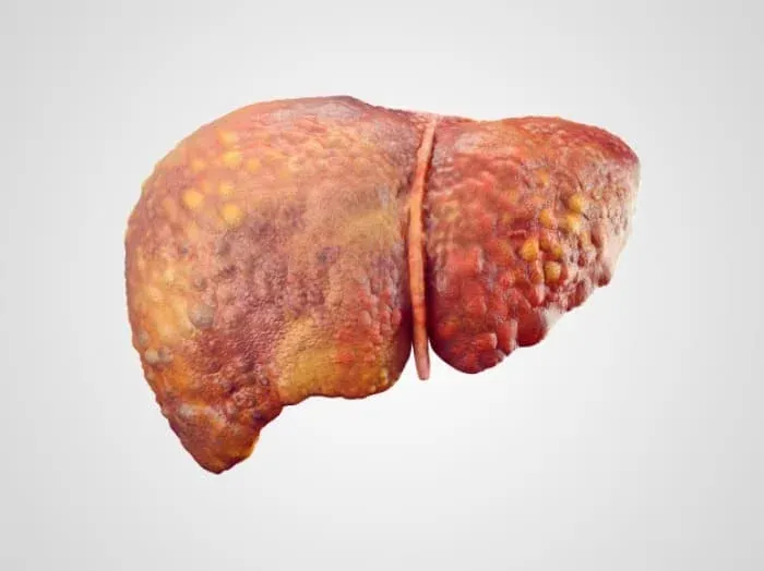 نوشابه