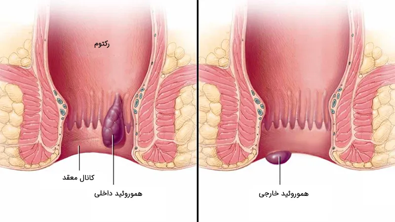 توالت
