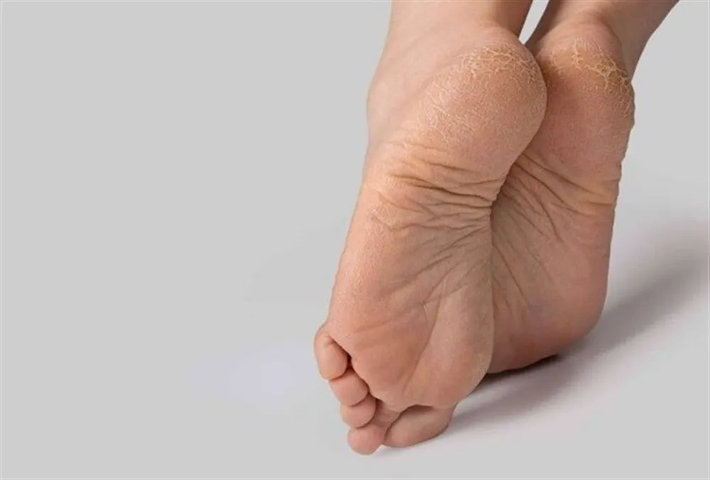 2 180