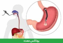 تخم کتان