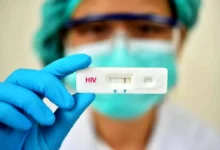 HIV