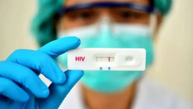 HIV