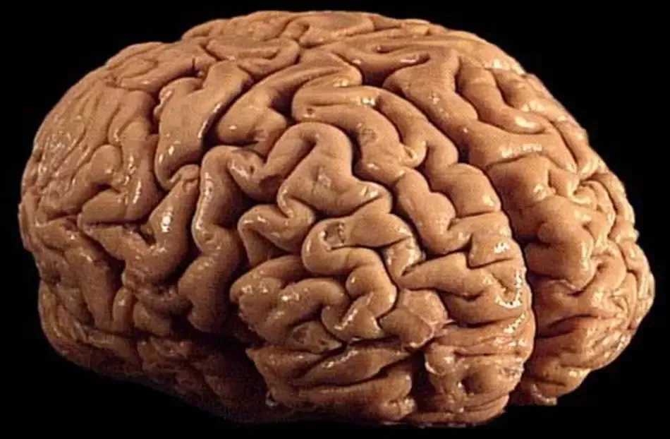 Brain