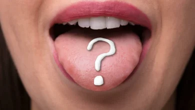 Dark Black Spots on the Tongue 1